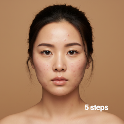 Macchie Addio – 5 Step